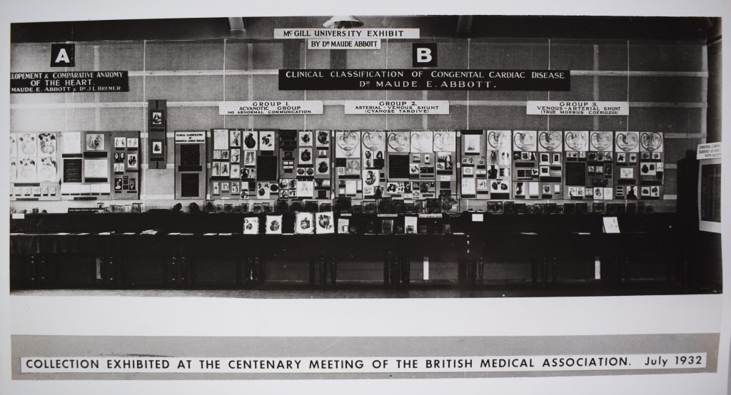 Photo en noir et blanc d’une exposition de spécimens médicaux à l’Université McGill. Le long d’un mur, des spécimens médicaux dans des contenants de vitre carrés sont présentés. 
