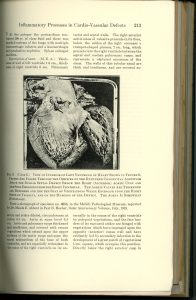 Page 203 of a book by Maude Abbott on the impact of bacterial inflammation on cardiovascular processes. The top of the page reads “Inflammatory Processes in Cardio-Vascular Defects”. Two columns of text explain the various processes. A black and white photograph in the centre of the page shows an interior view of the left ventricle of a heart.