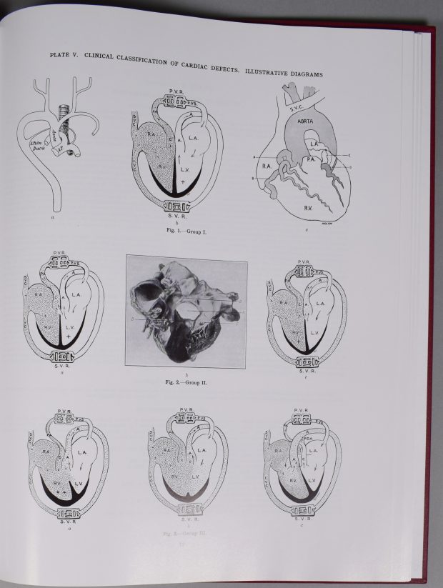 Photograph of page 12 of Maude Abbott’s Atlas. The top of the page reads “Plate V. Clinical Classification of Cardiac Defects. Illustrative Diagrams”. The page shows 9 figures representing different views of a heart.