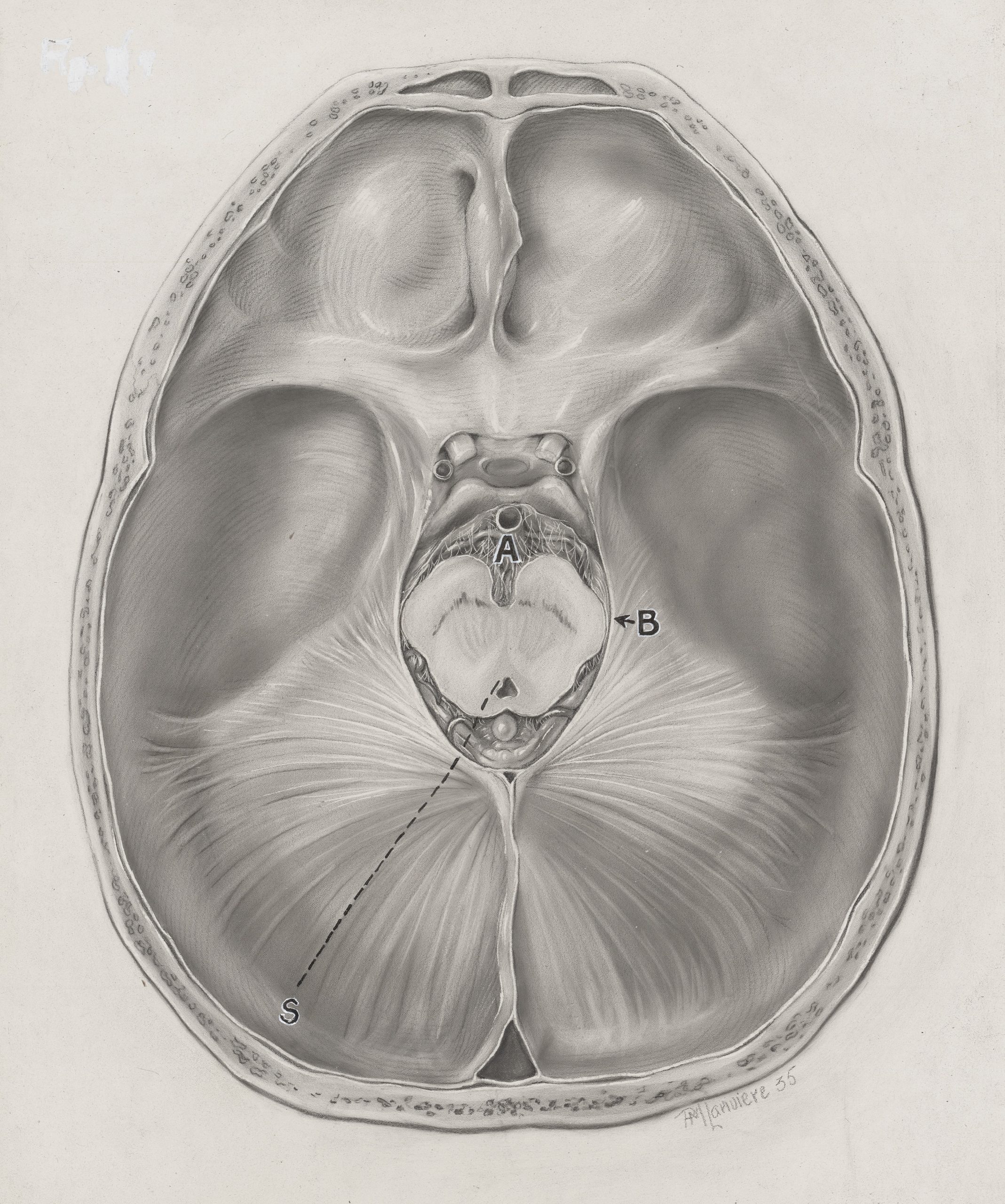 Black and white carbon dust drawing of a brain segment by Pauline Larivière