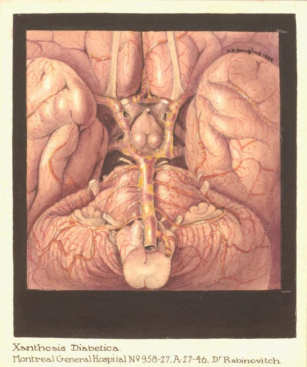 Medical illustration of internal organs done in red and orange tones. Drawing is surrounded by a black border and signed at the top right within the drawing.