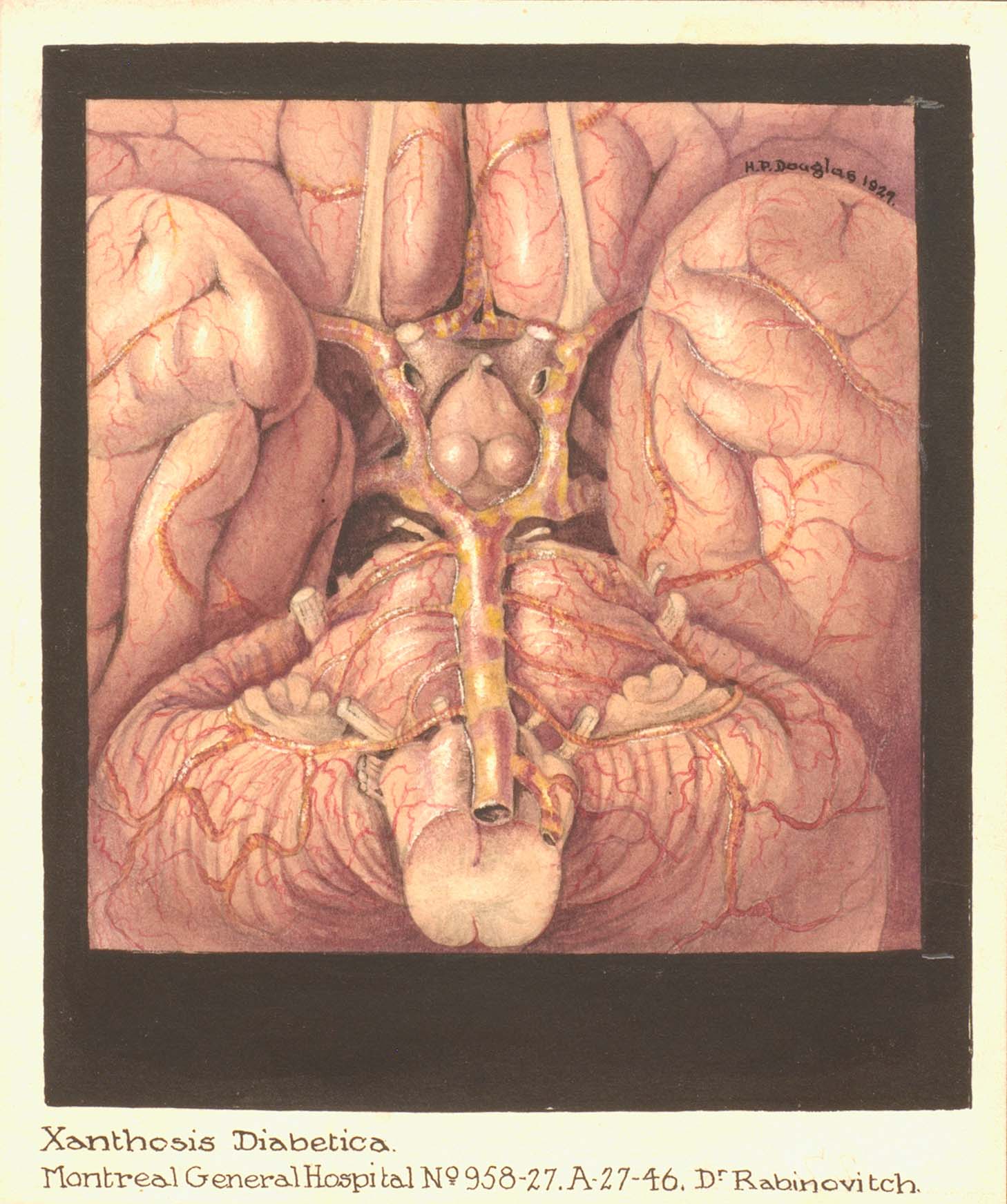 Medical illustration of internal organs done in red and orange tones. Drawing is surrounded by a black border and signed at the top right within the drawing.