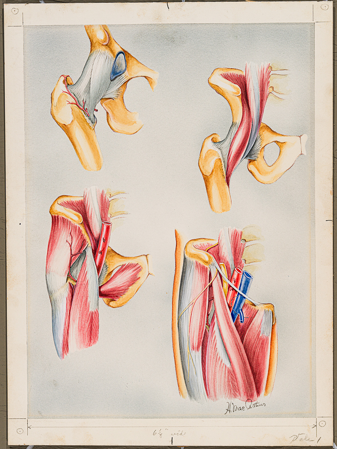 Colour medical illustration of the muscles and ligaments in the hip by Helen MacArthur.