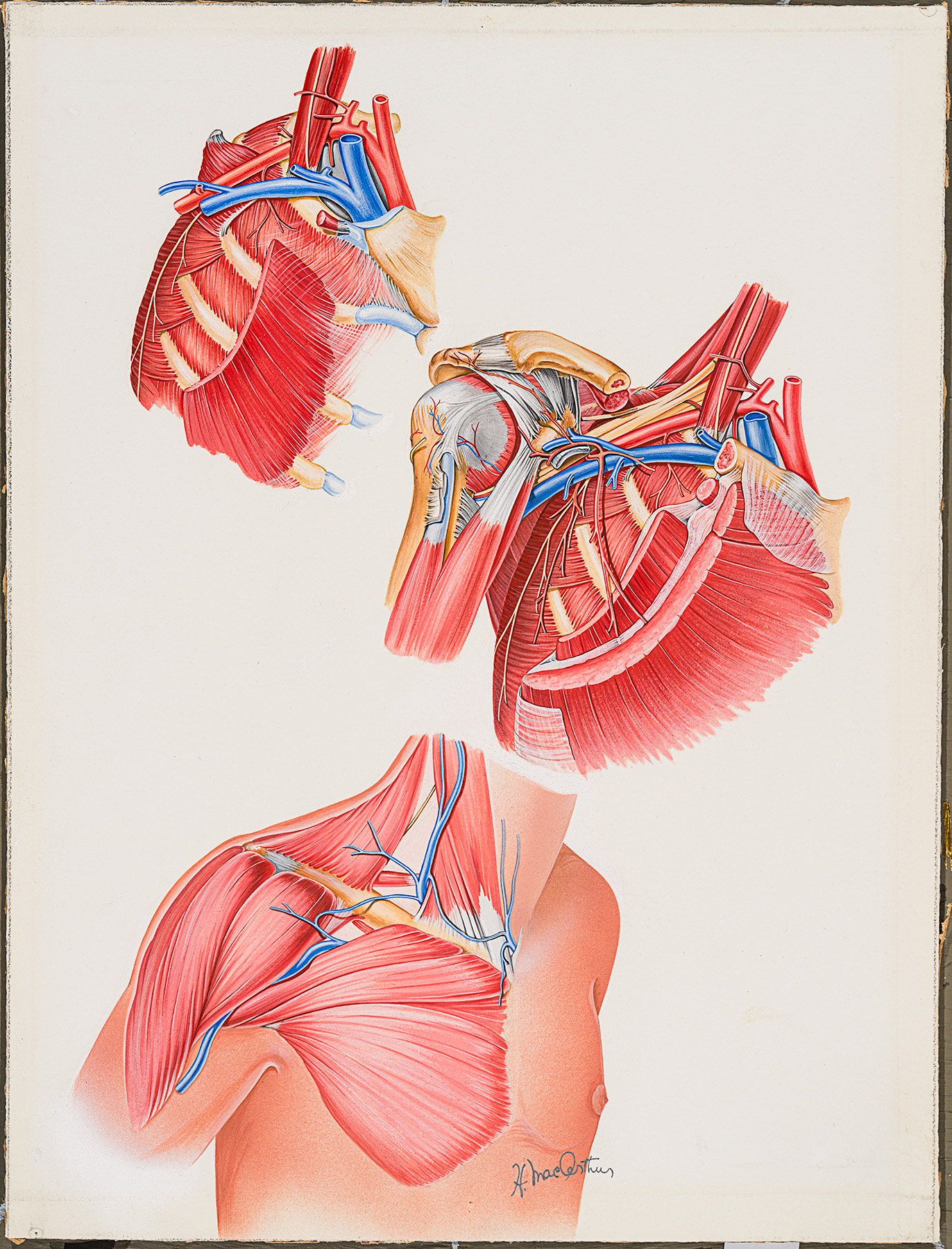 Colour medical illustration of the muscles and ligaments in the shoulder by Helen MacArthur.