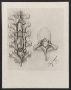Black and white sketch of a spinal column with a separated vertebra next to it. In the bottom right corner, there is a stylized signature by Pauline Larivière, 1941.