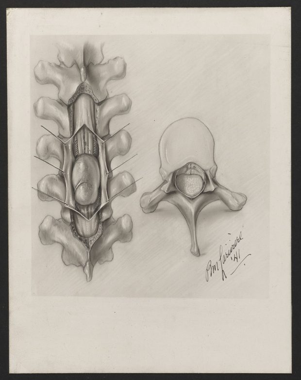 Black and white sketch of a spinal column with a separated vertebra next to it. In the bottom right corner, there is a stylized signature by Pauline Larivière, 1941.