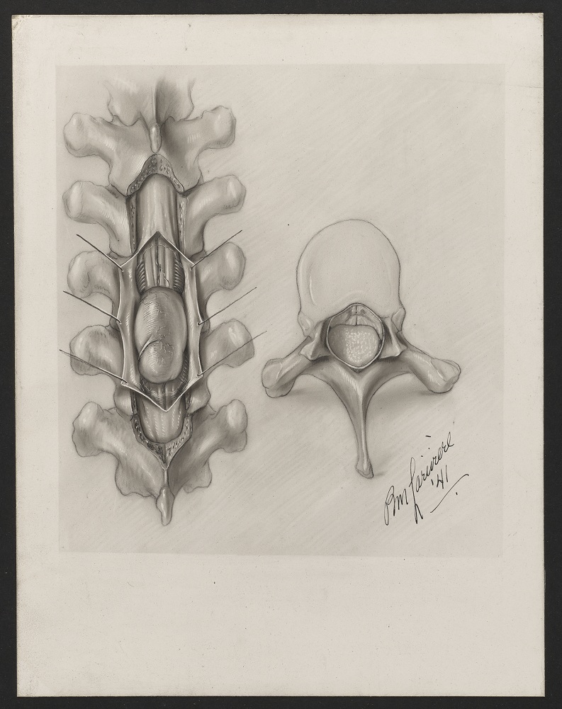 Croquis en noir et blanc d'une colonne vertébrale avec une vertèbre isolée à côté. En bas à droite, la signature stylisée de Pauline Larivière, 1941.