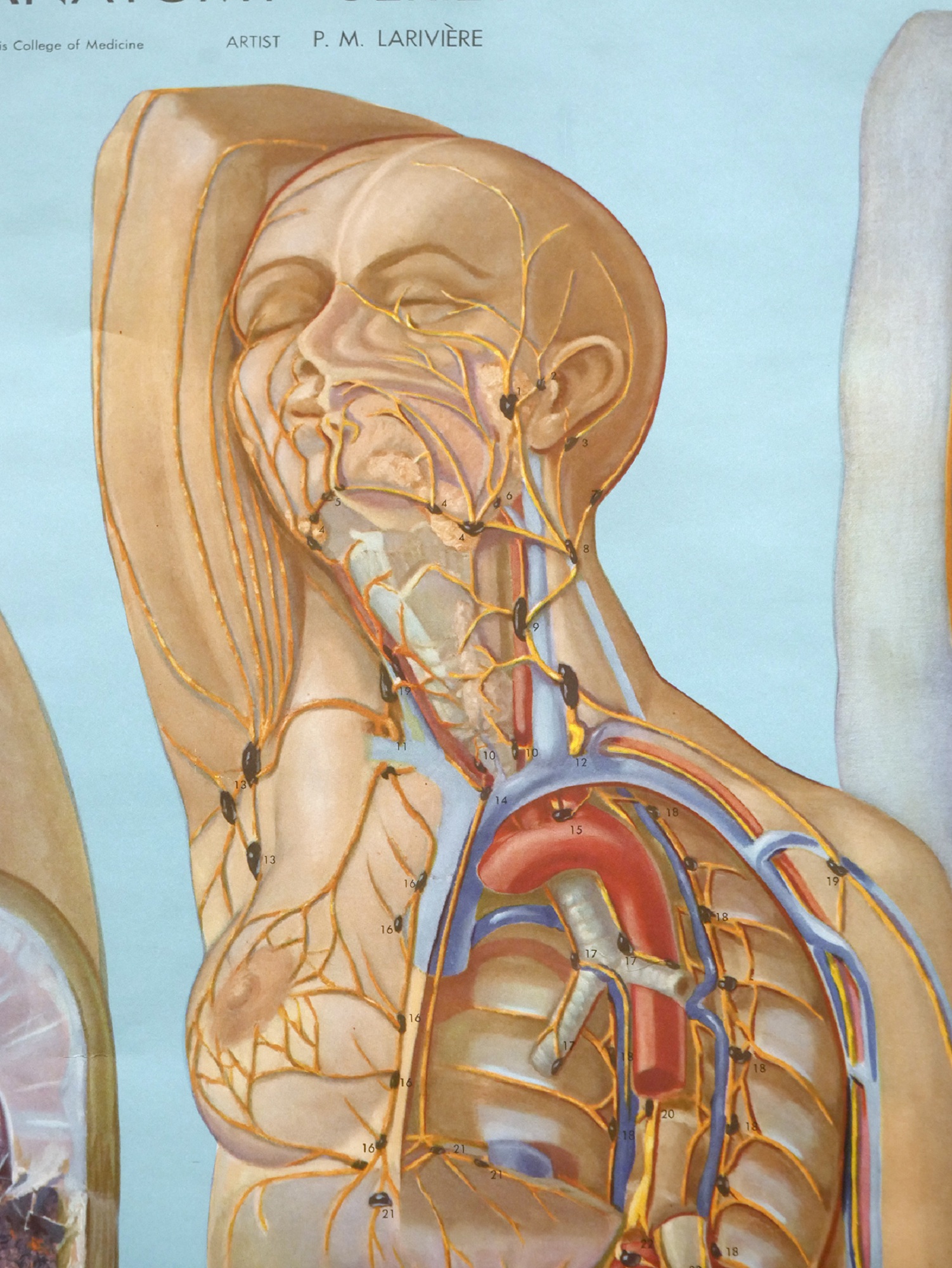 Colour illustration of a woman with exposed arteries holding her hand behind her head.
