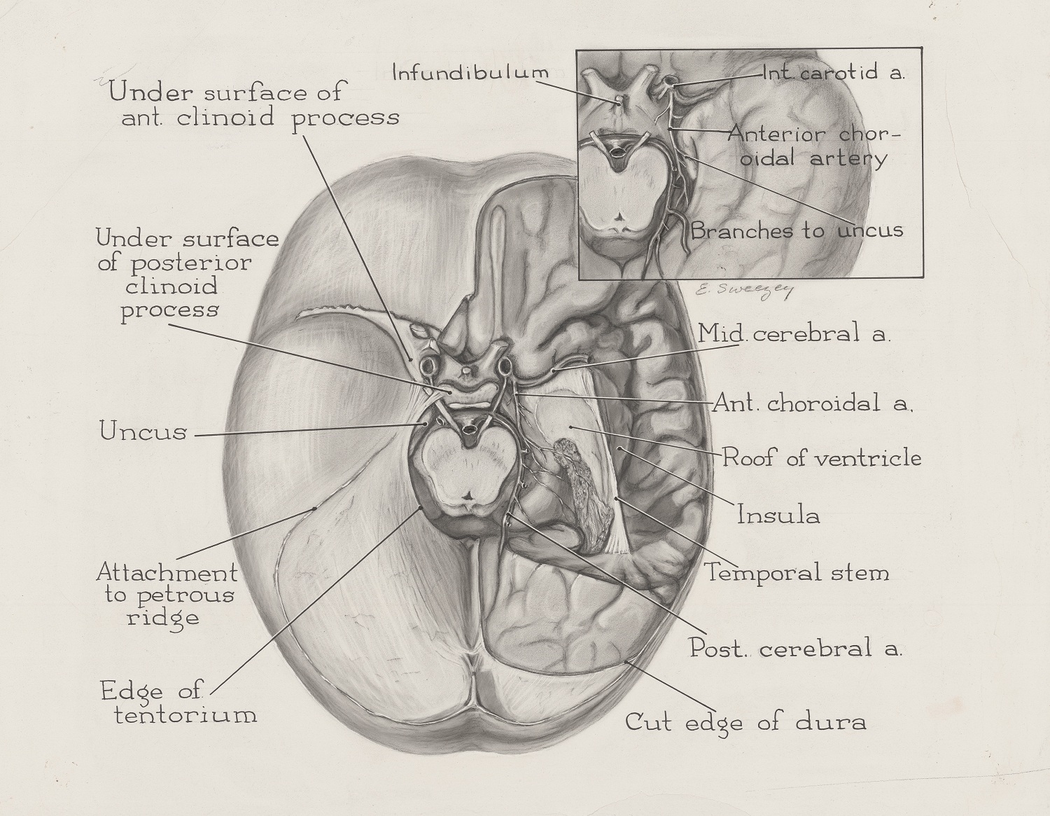 Black and white illustration of a cross-section of the brain.