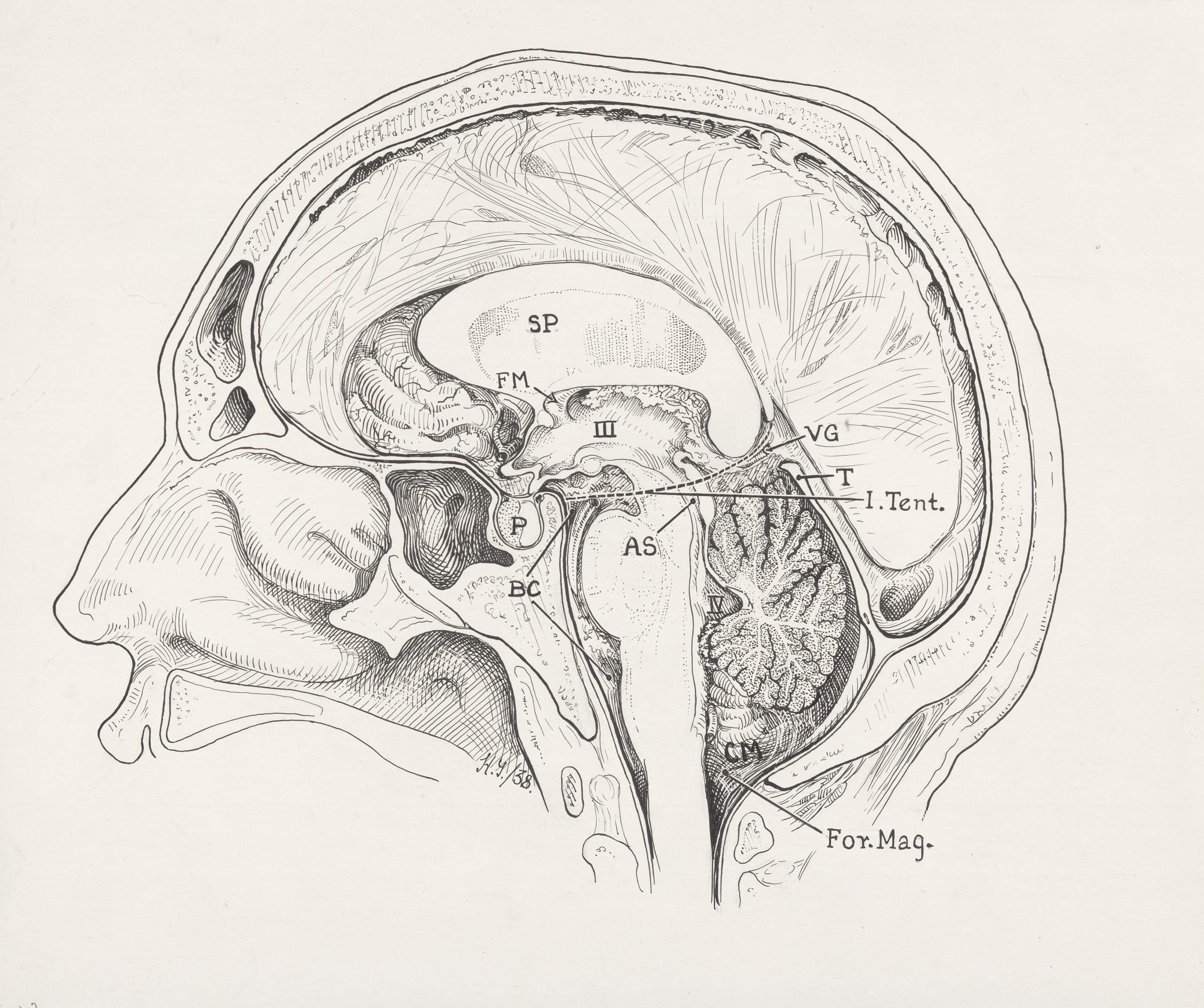 Illustration médicale en noir et blanc d'une coupe transversale de la tête, réalisée au crayon.