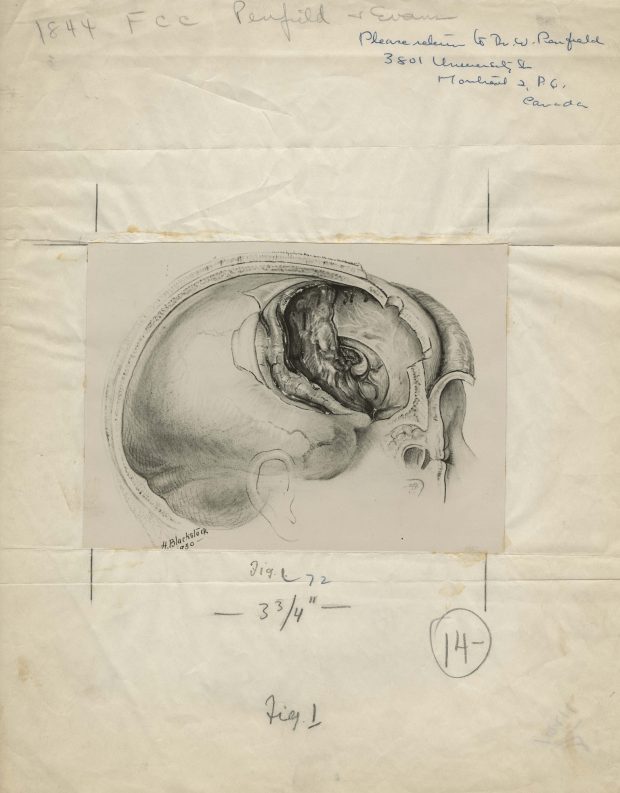 Black and white cranial medical illustration, signed and dated at the bottom left, mounted on crinkled newsprint with notes regarding publication details.