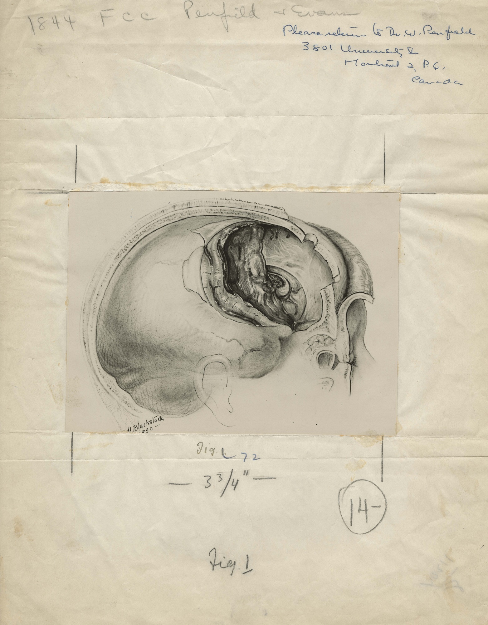 Black and white cranial medical illustration, signed and dated at the bottom left, mounted on crinkled newsprint with notes regarding publication details.