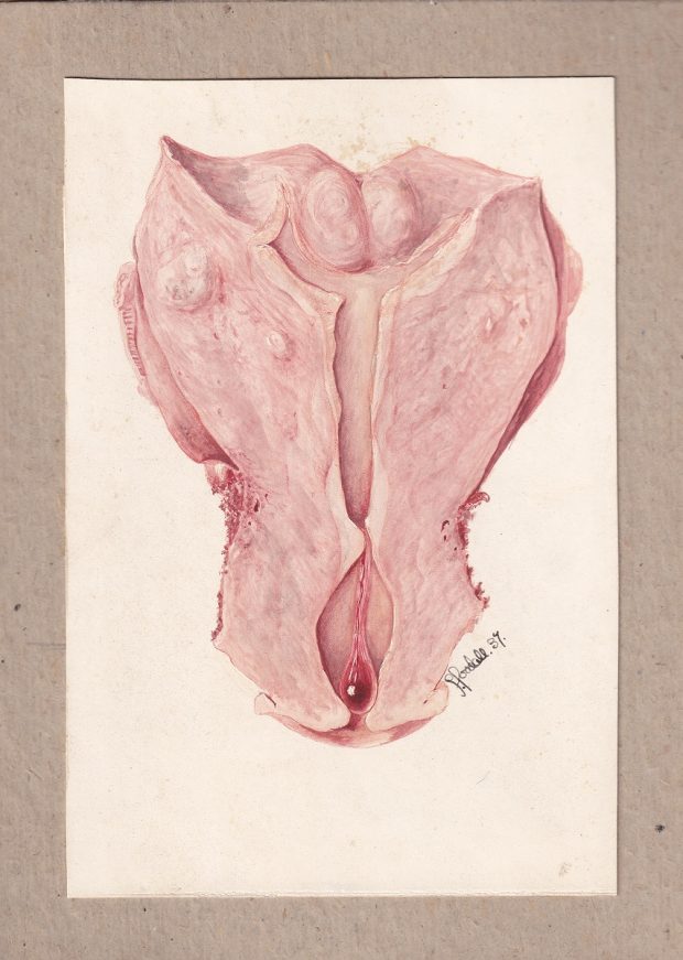 Medical illustration done in watercolour in pink and red tones on a cream background, signed at the bottom right.