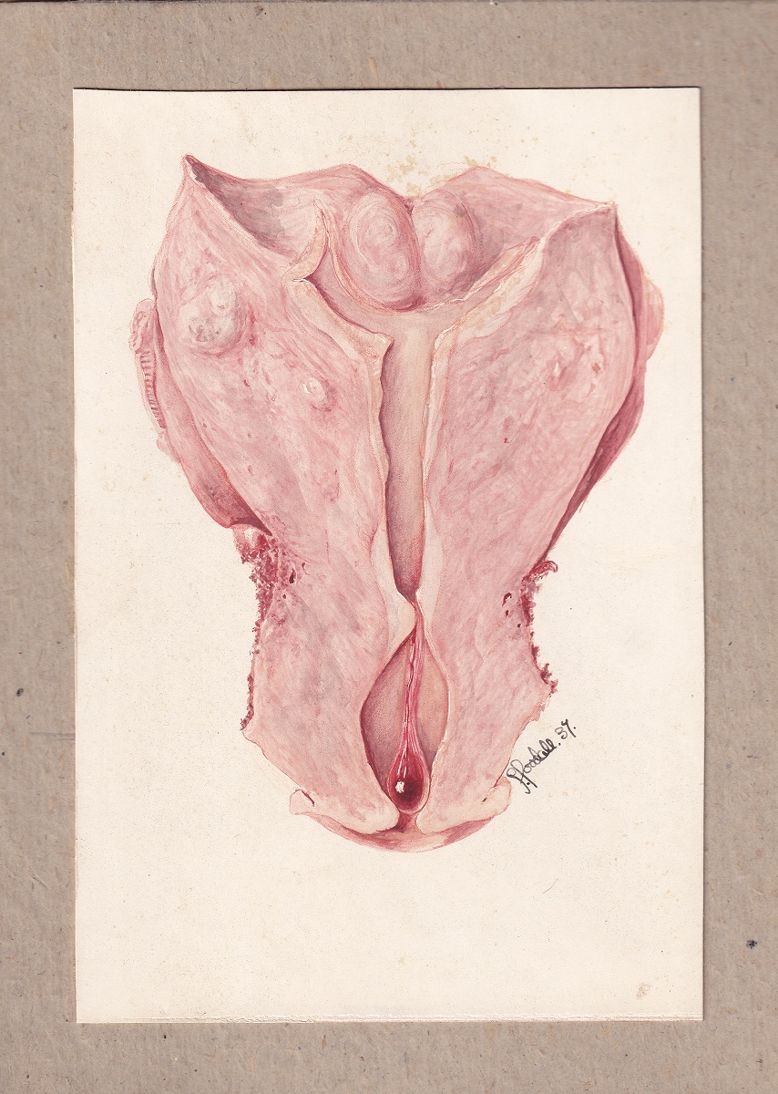Medical illustration done in watercolour in pink and red tones on a cream background, signed at the bottom right.