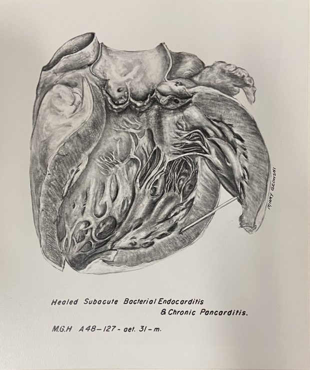 Black and white illustration of a heart, cut in half and splayed open.