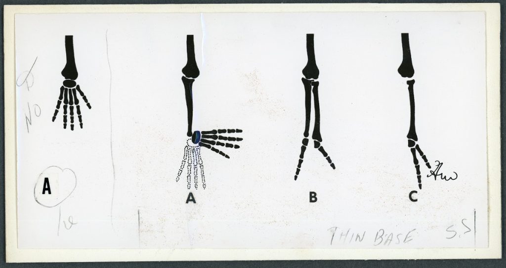 Black and white illustration of the bones of the hand in different articulations.