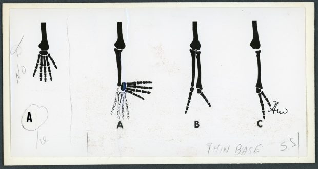 Black and white illustration of the bones of the hand in different articulations.