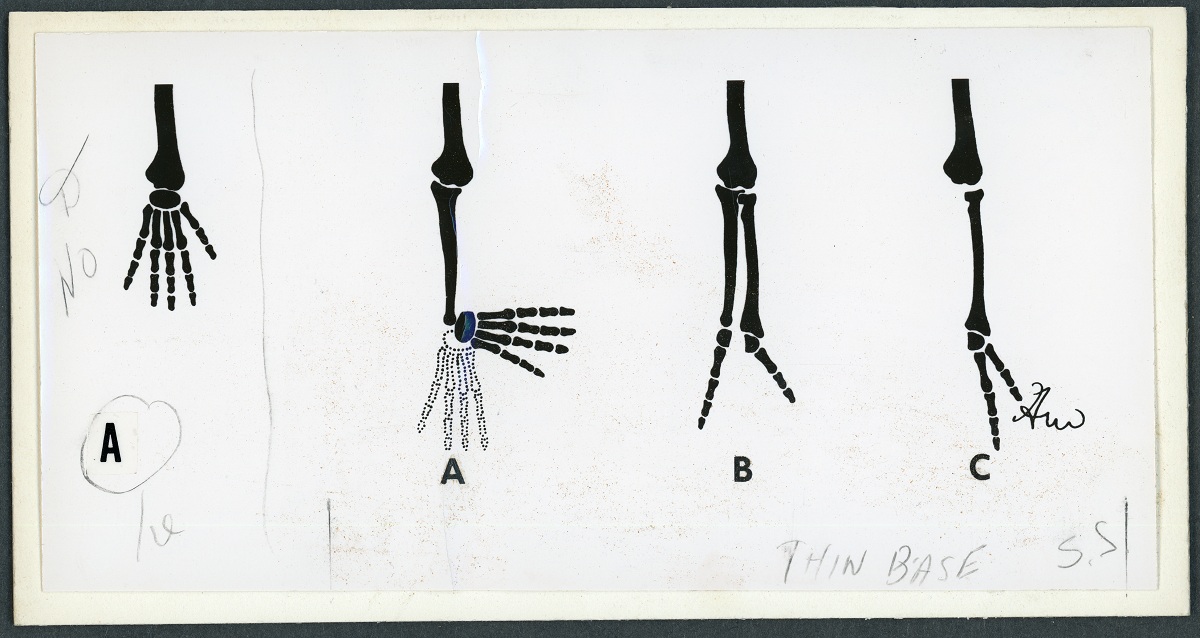 Black and white illustration of the bones of the hand in different articulations.