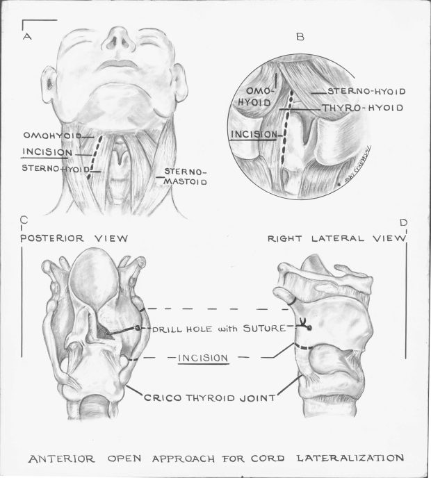 Black and white illustration of the interior and exterior of the throat.