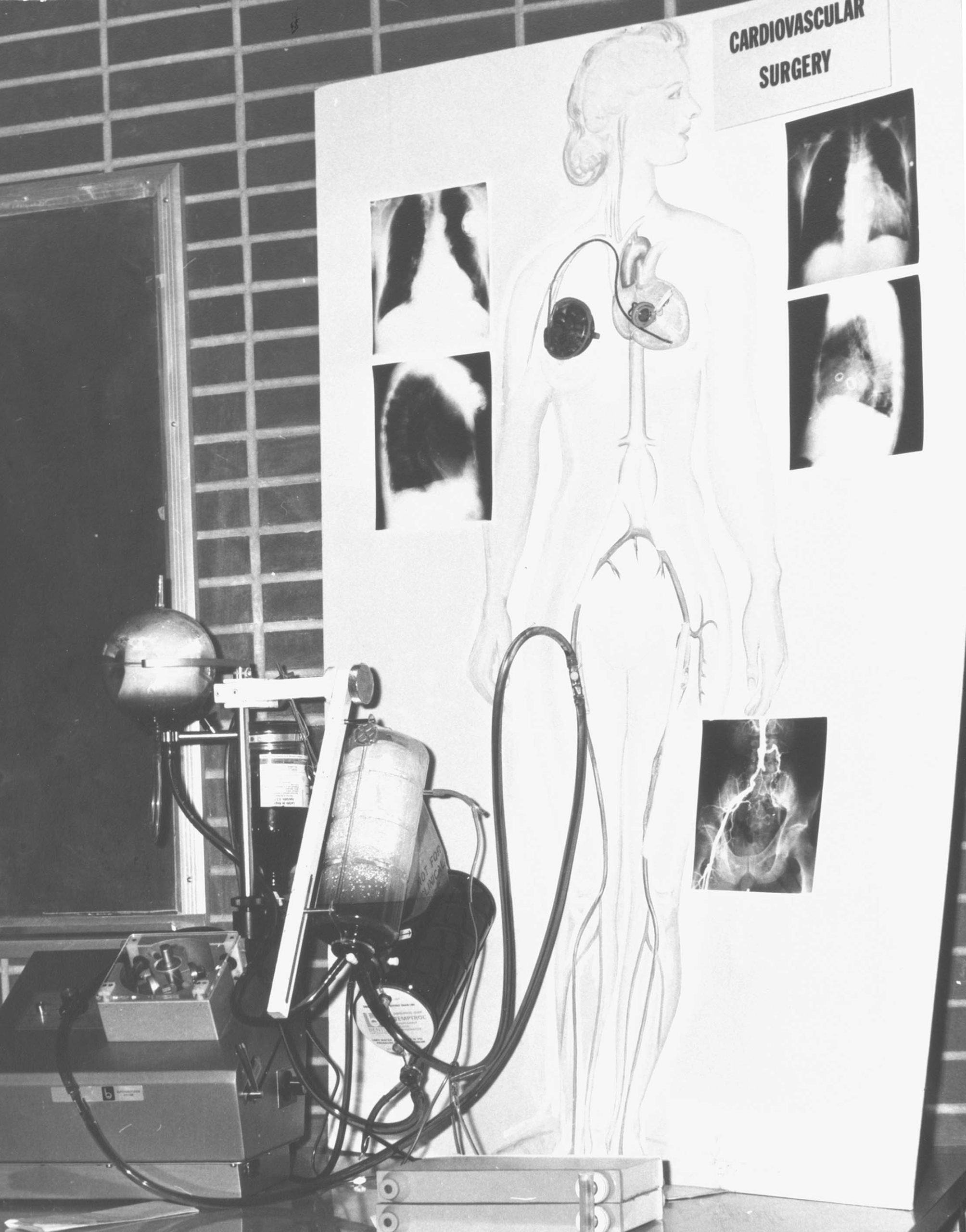 Black and white photo of a medical illustration attached to a medical device for Cardiovascular Surgery. The illustration depicts a woman with exposed arteries and heart.