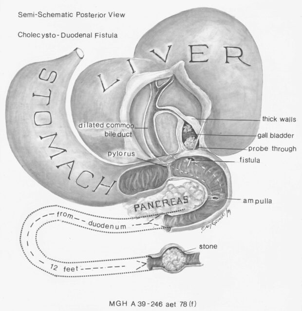 Black and white illustration showing the liver, stomach and other organs.